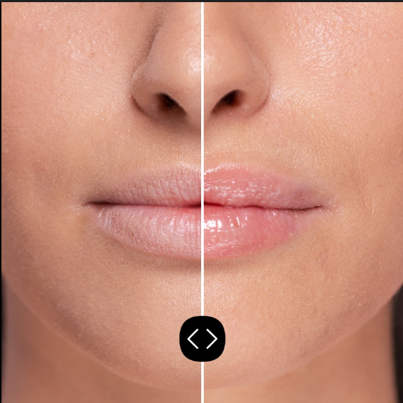 Gloss/Volumizant intens pentru Buze